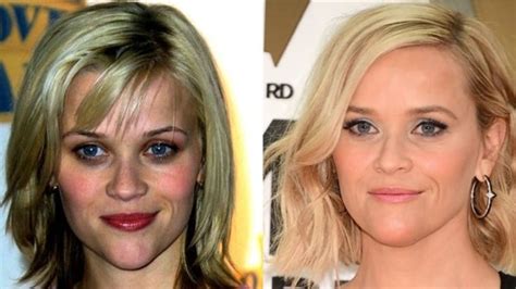 reese witherspoon breasts|Reese Witherspoon Plastic Surgery: Before and After ...